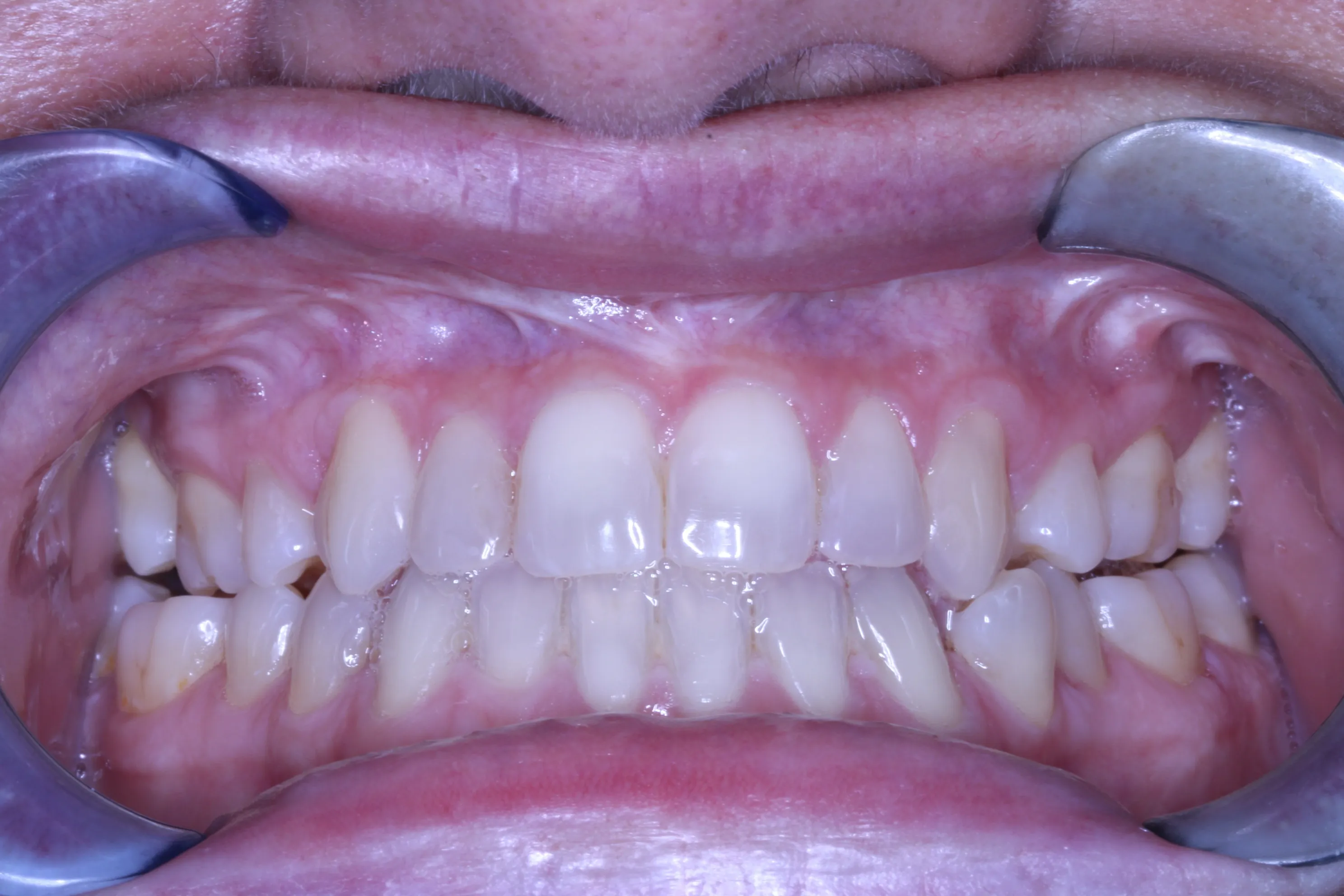 smile-gallery gallery